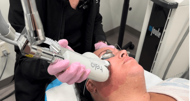 Halo Laser in Richmond, VA 