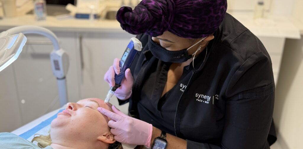 How Long Does Microneedling Last? 